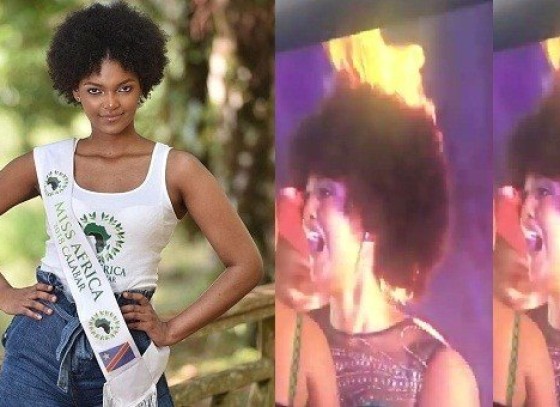 Miss Africa 2018 Güzeli’nin Saçları Alev Aldı!